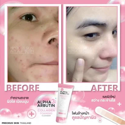 Precious Skin Alpha Arbutin 3+ Collagen Foaming Cleanser – 120 g